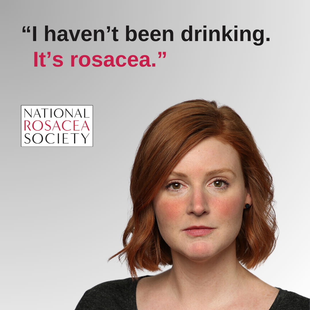 downloadable image saying i haven't been drinking its rosacea