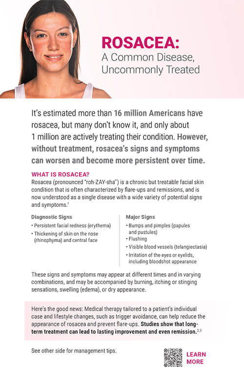 rosacea informational postcard