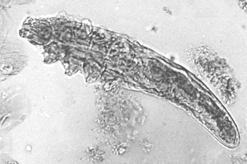 Demodex mite