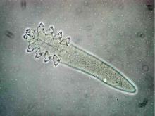 Demodex mite